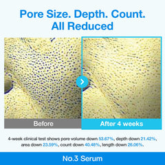 Numbuzin No.3 Blue Bio-Retinol Pore Refining Serum 30ml